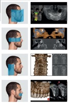 biocare_cbct1